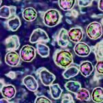 Heartbreaking video shows deadly risk of skipping measles vaccine